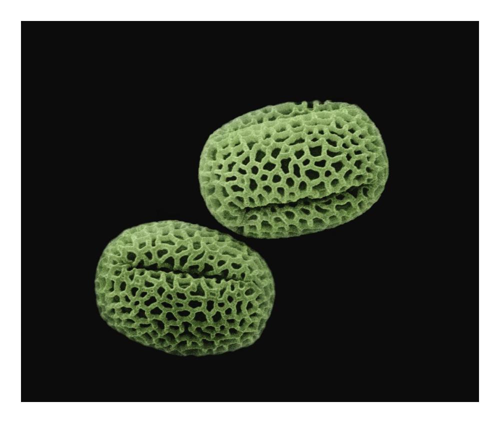 Olive (Olea europaea) pollen at 1400x magnification-Paper Art-24"x20.26"