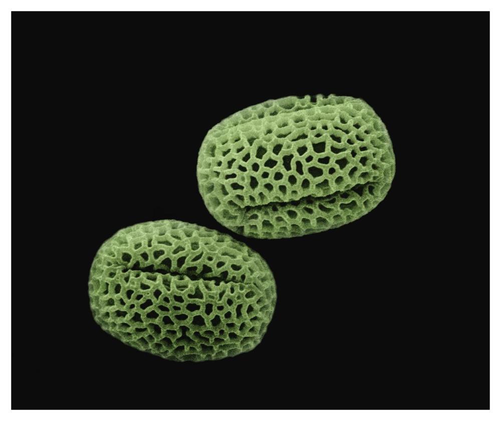 Olive (Olea europaea) pollen at 1400x magnification-Paper Art-46"x38.52"
